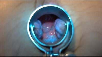 speculum play 8 min all gay porn video