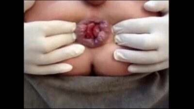 gay ass hole extrem gape all gay porn video
