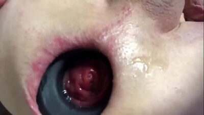 ANAL GAPING ANAL PROLAPSING ANAL VACUUM PUMPING COMPILATION all gay porn video