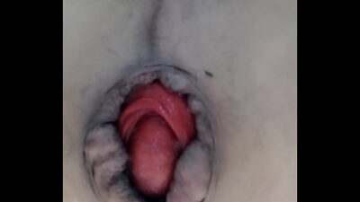 Mi prolapso all gay porn video