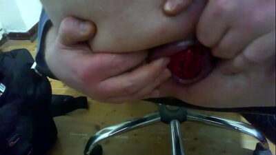 tentativo di prolasso all gay porn video