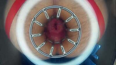 Dilatation anus 28 nov 2022 all gay porn video