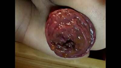 big juicy red prolapse all gay porn video
